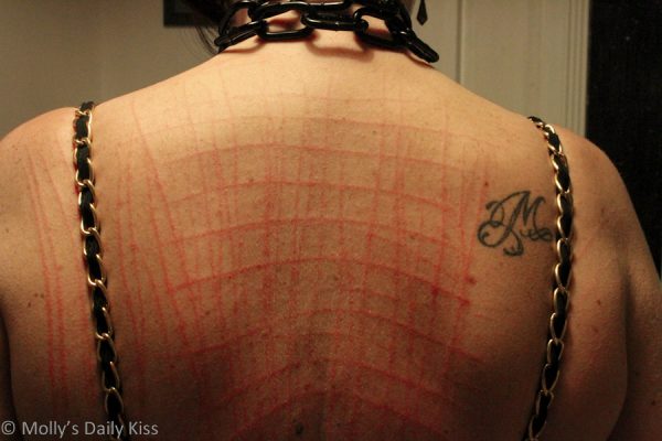 scratch marks on womans back